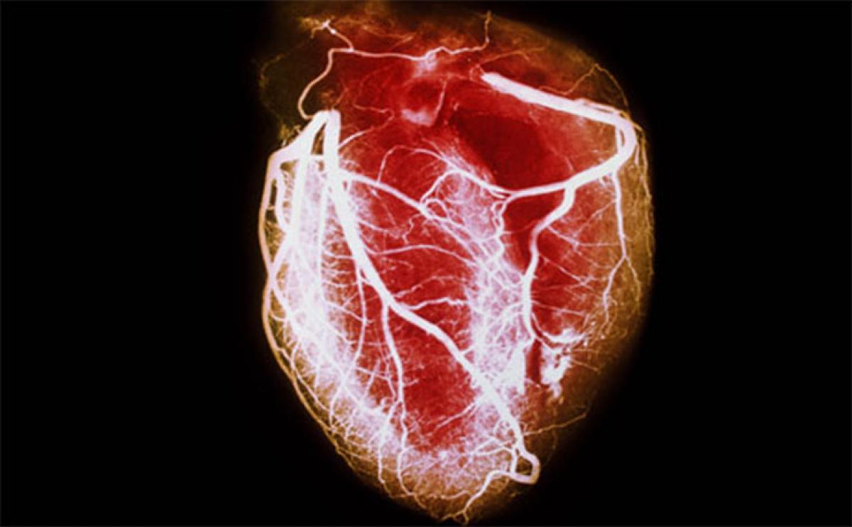FAQs about heart disease, prevention treatment Dr Devi Shetty Cardiologist