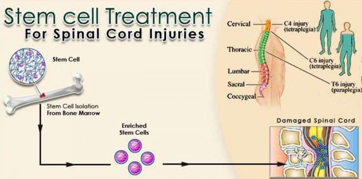 Stem Cell treatment is effective in recovery of spinal injuries