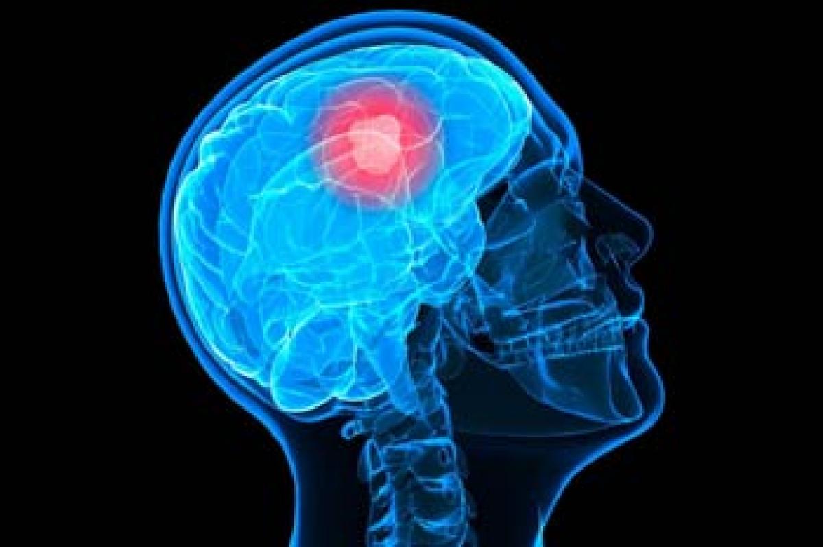 Blocking a key protein may stop deadly brain tumour formation