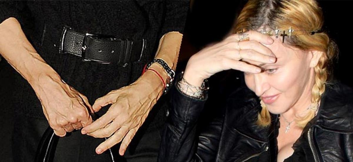 How much did Madonna spend on treating wrinkled hands?