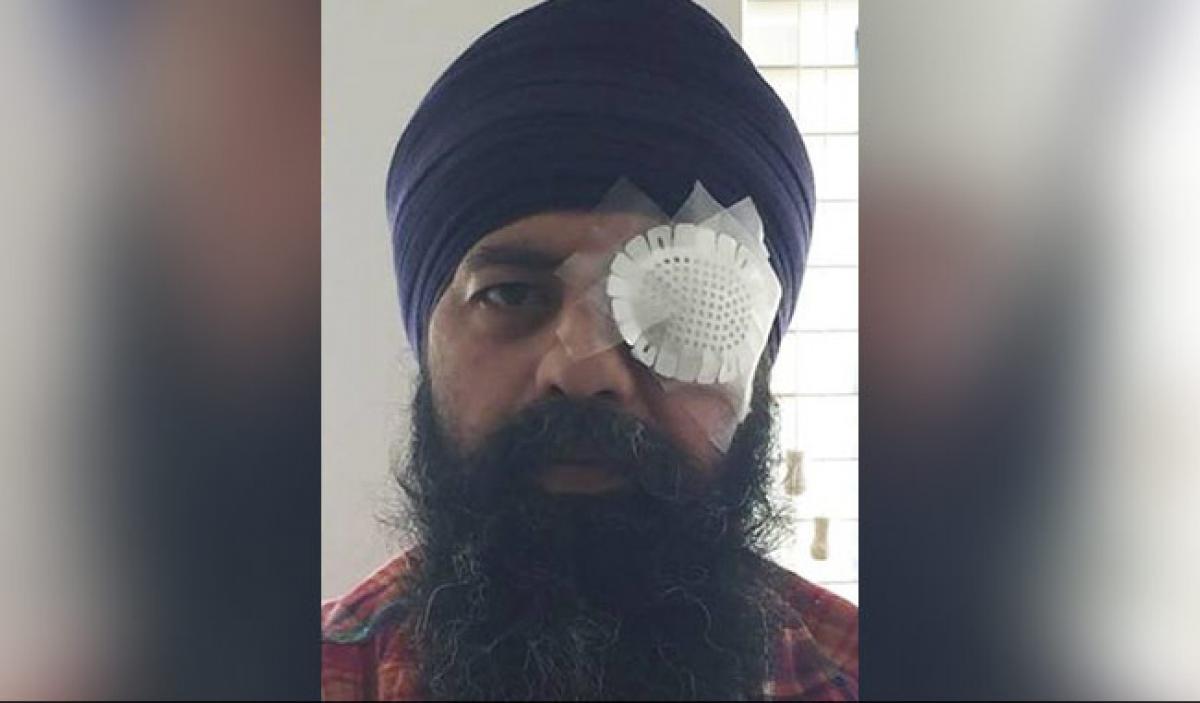 Sikh techie brutally attacked in alleged hate crime in US