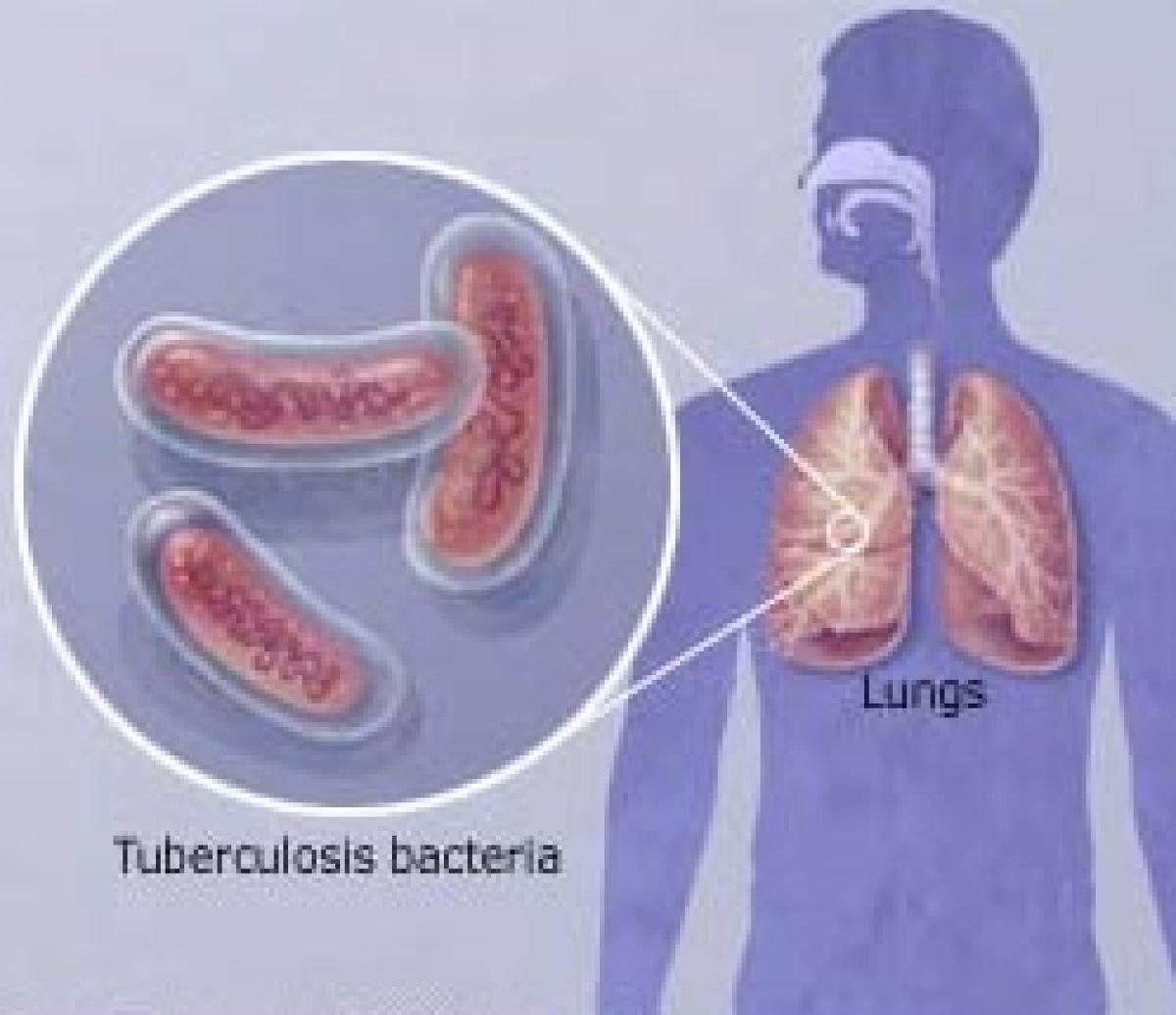 People told to be careful about TB