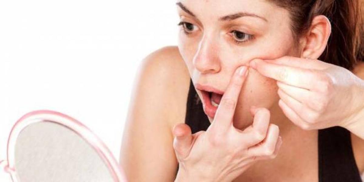 Protect yourself from acne in simple steps