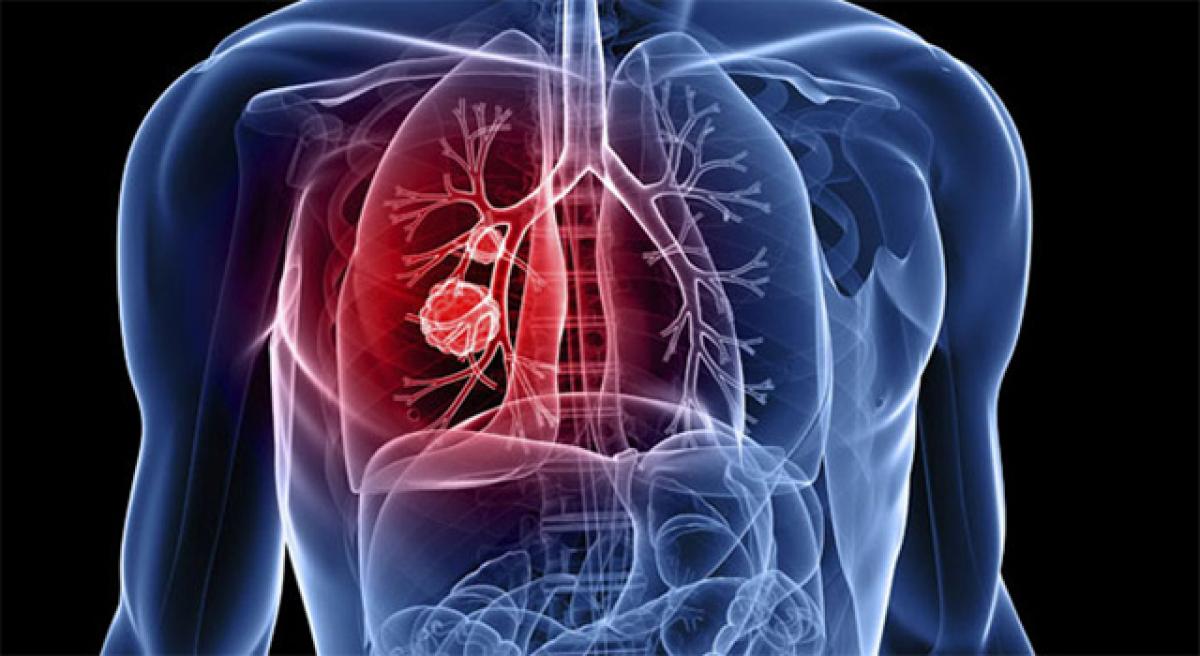 Lung cancer cases increase every year