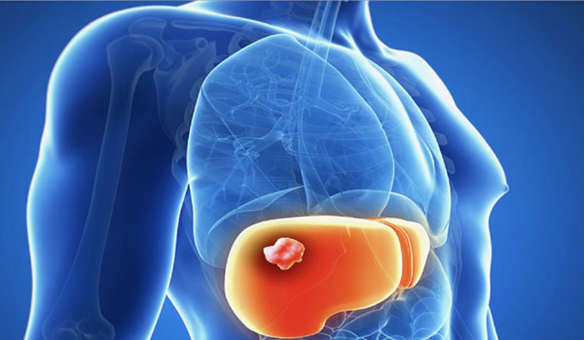 New liver cancer drug gets FDA approval