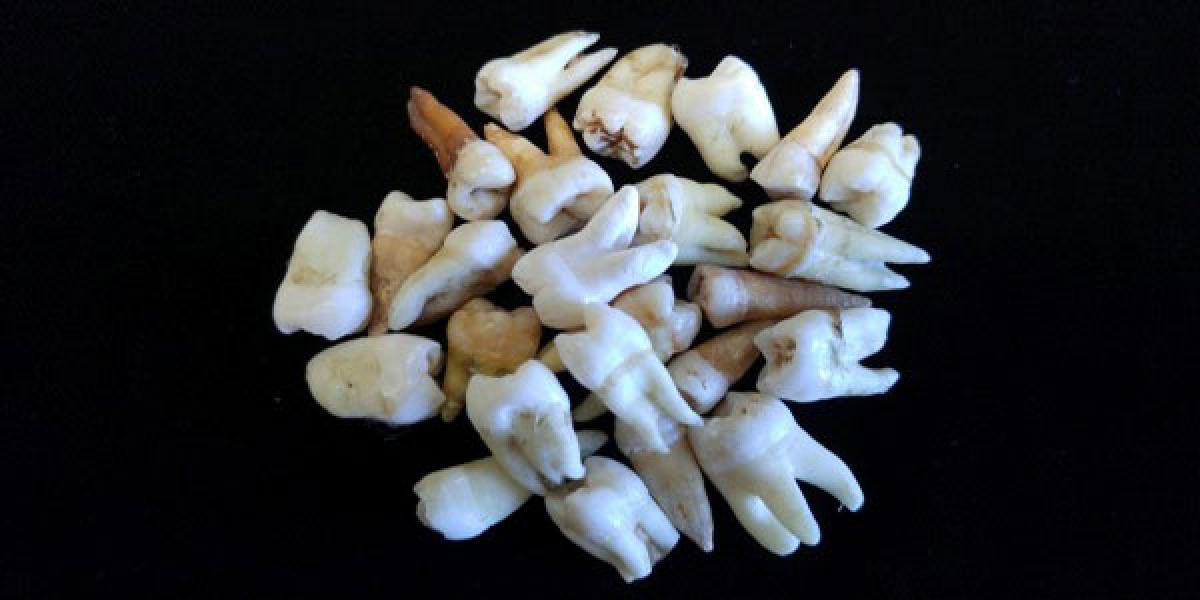 Human teeth, a repertoire of evolutionary information