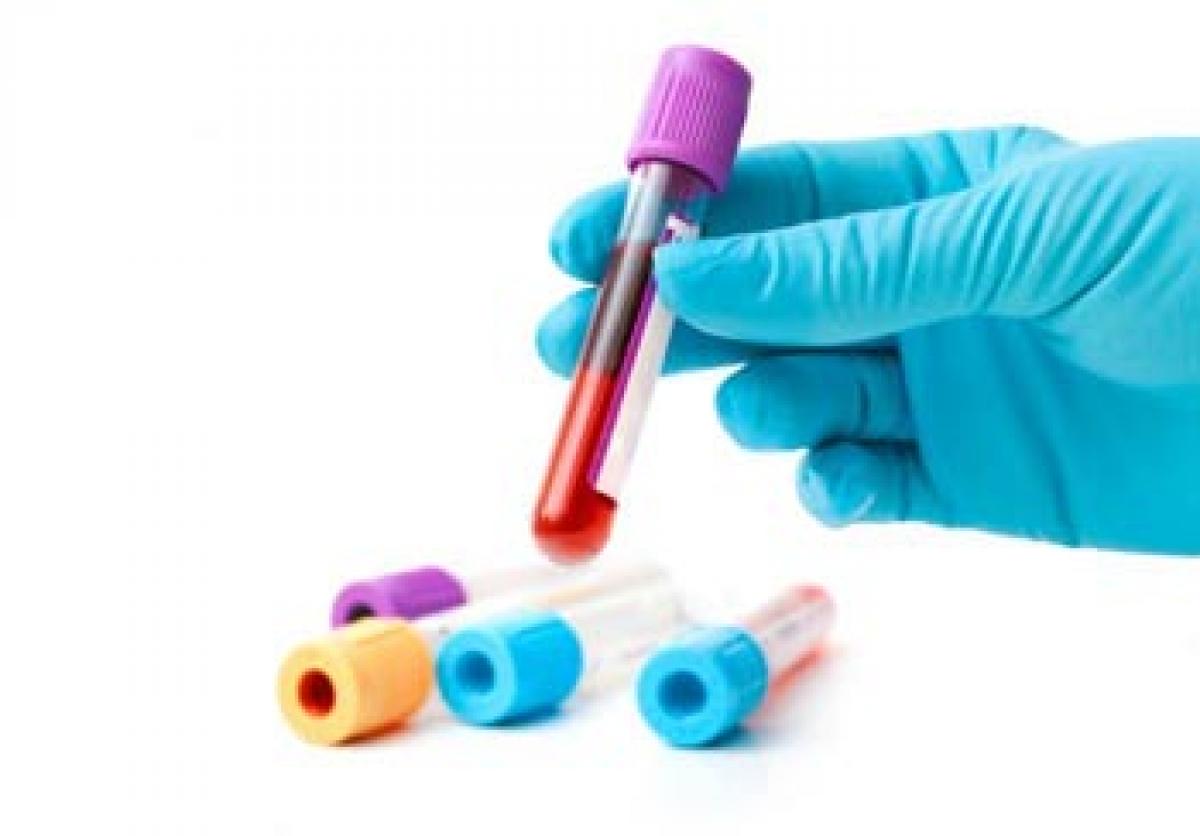 Simple blood test can tell if you are at arthritis risk