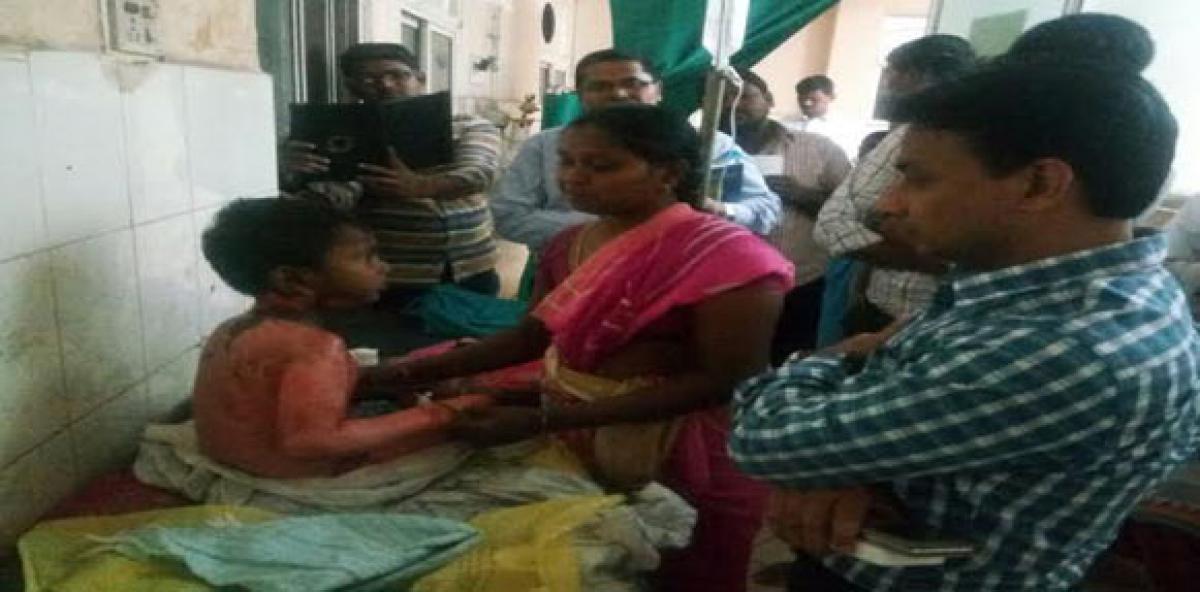 Class I boy falls into hot sambar, suffers severe burns