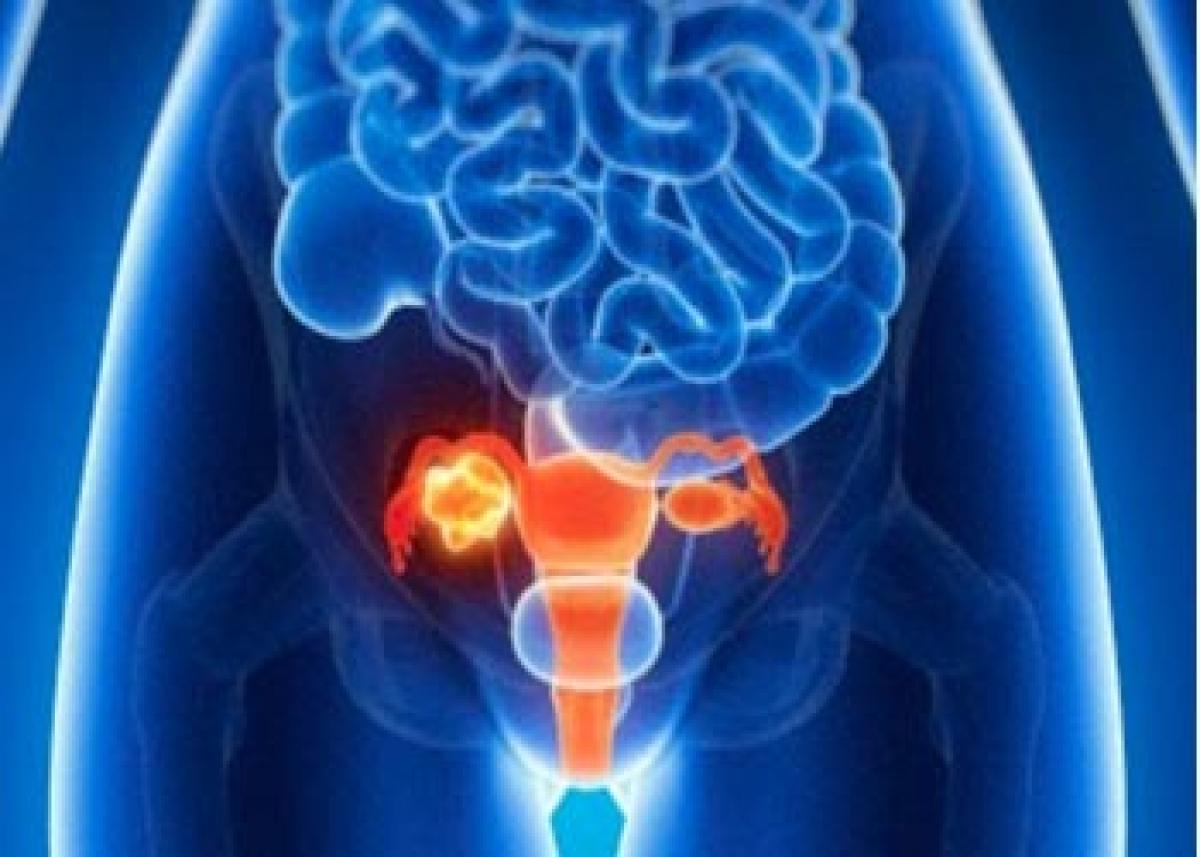 Protein that can predict ovarian cancer early identified.