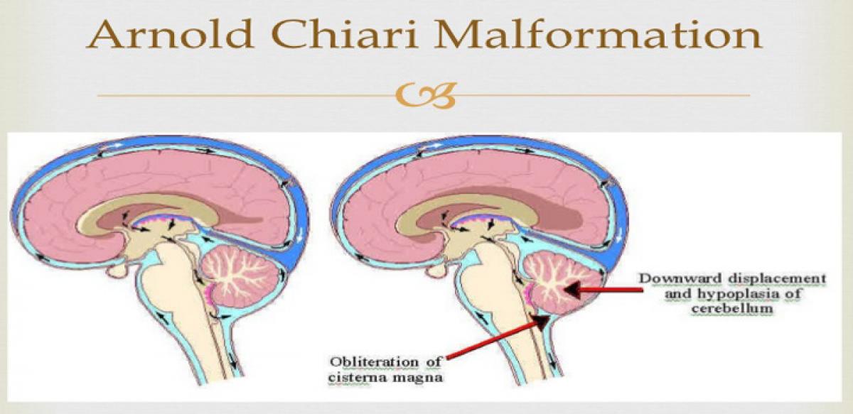 Path Breaking Spinal Surgery