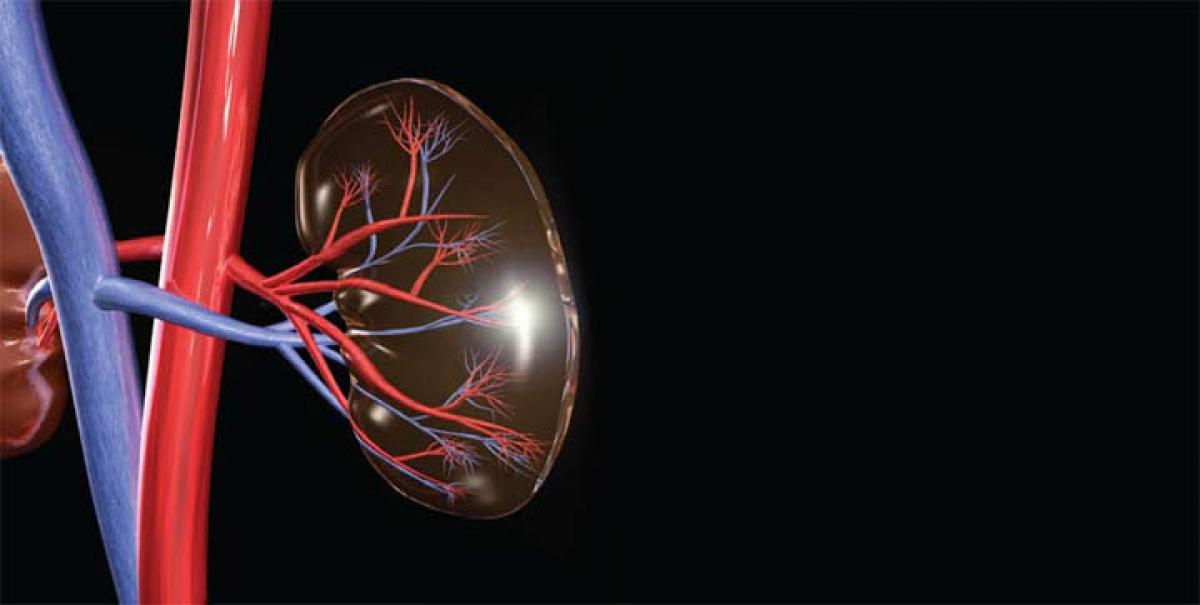 Advanced kidney disease may make you poor