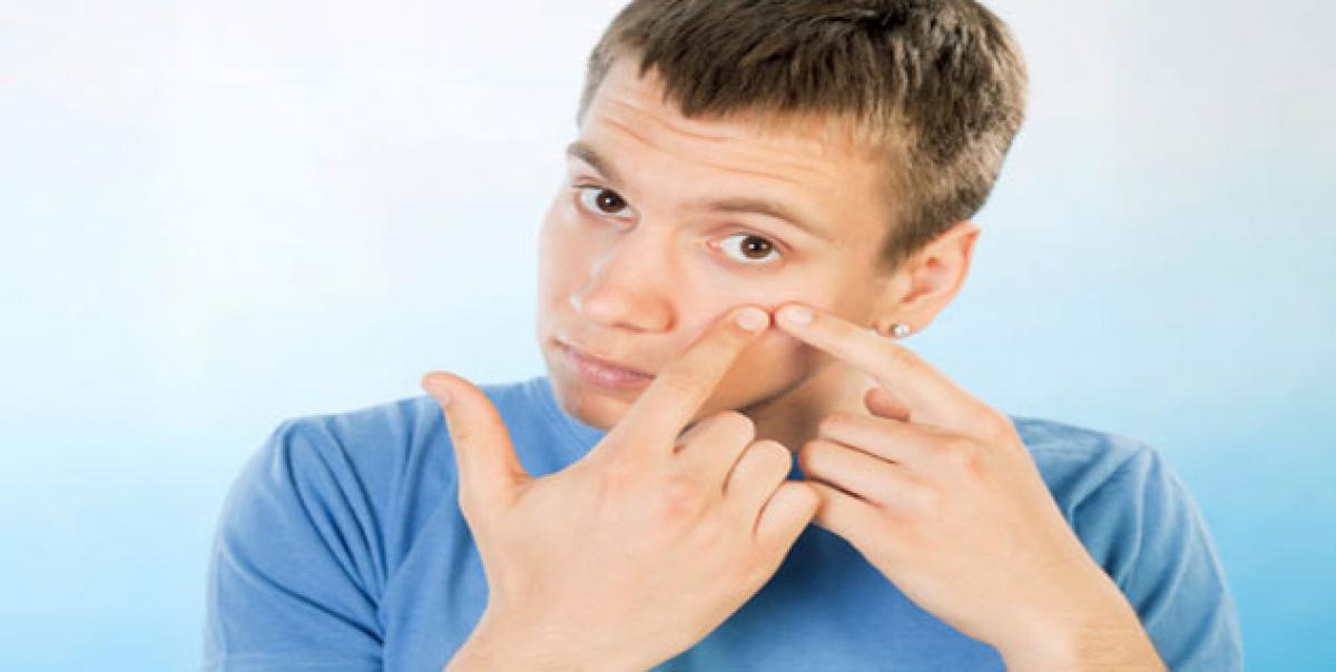 Skincare tips for men: How to tackle pimples