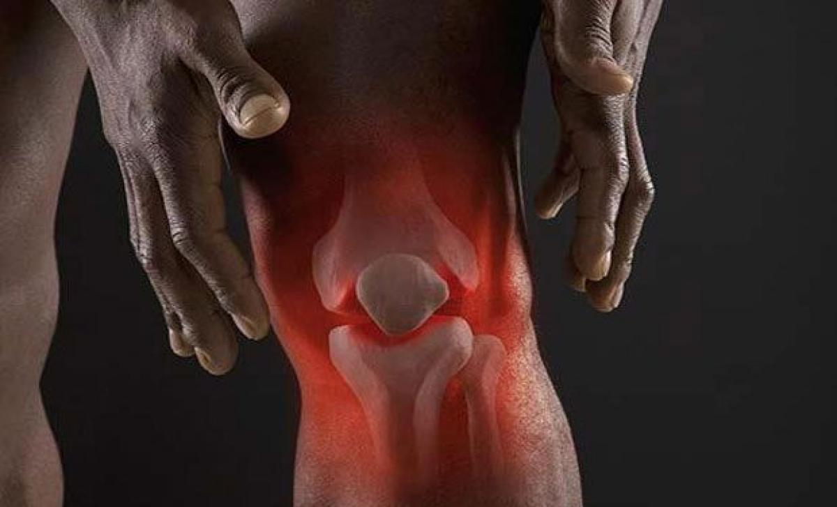 Men can fight rheumatoid arthritis with high BMI