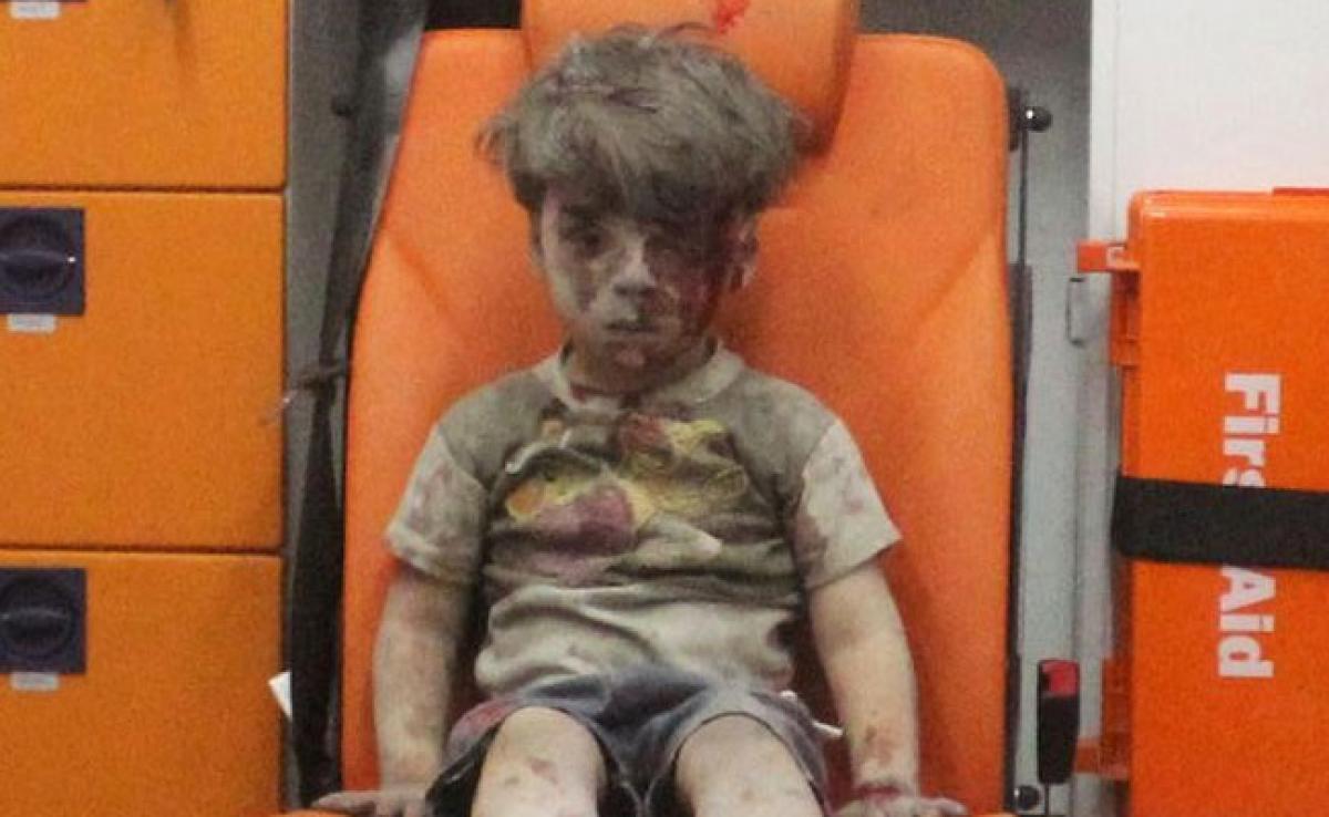 New Images Emerge Of Syrian Boy Bloodied In Iconic Aleppo Photo