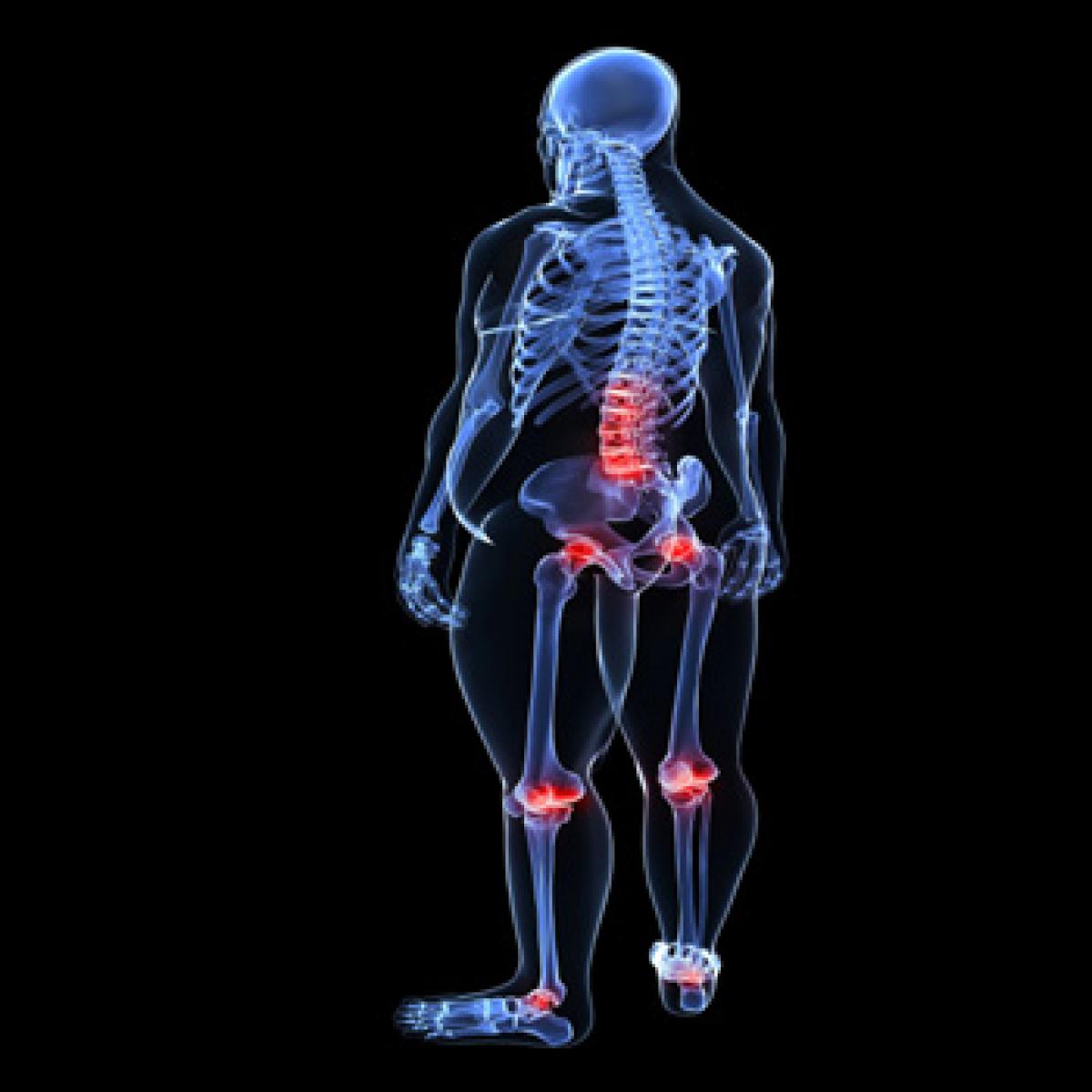 The burden of obesity on joints