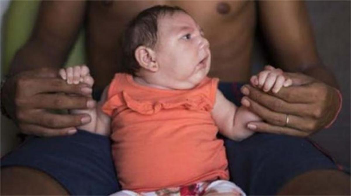 The Zika virus has been transmitted sexually: US health authorities