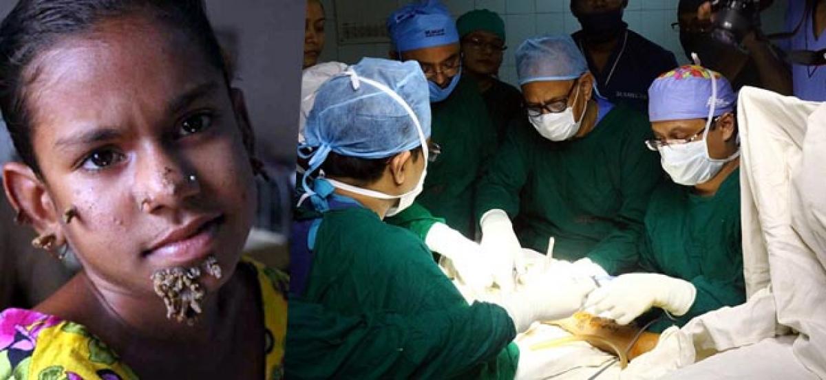 Bangla girl with tree man disease undergoes surgery
