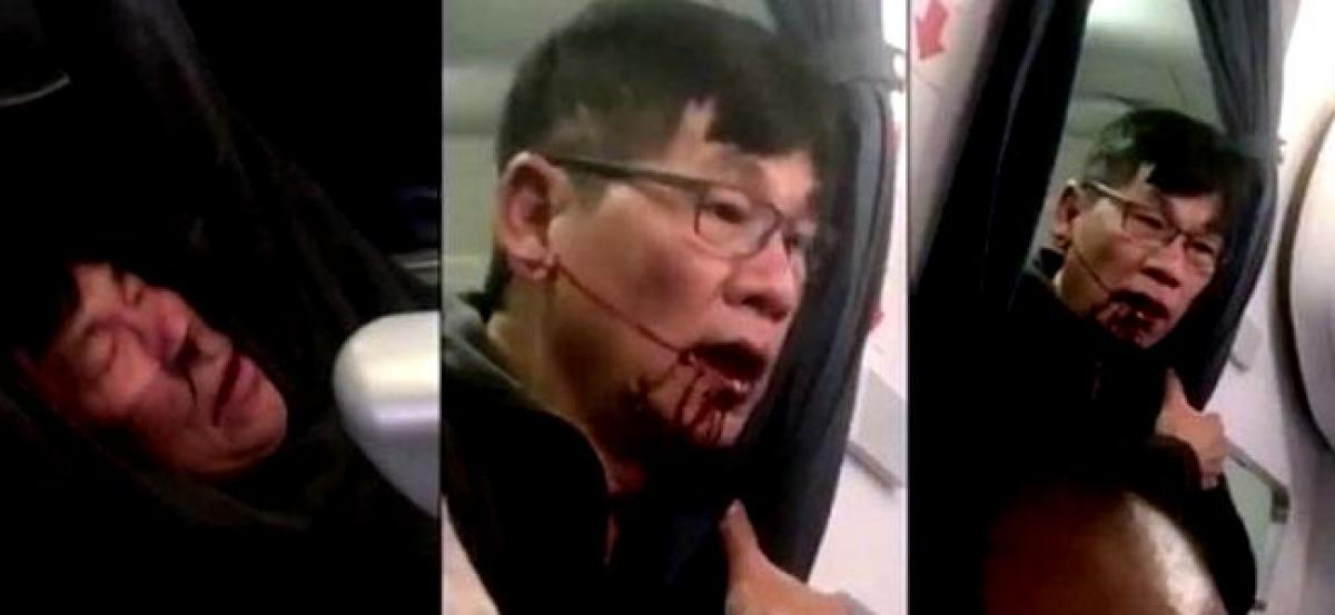 United Airlines attack: Lawyer says dragged passenger will need reconstructive surgery