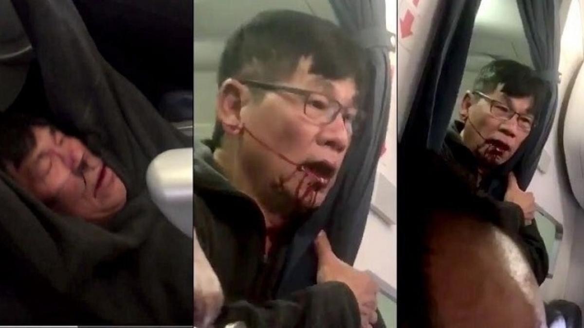 United Airlines reaches amicable settlement with dragged passenger David Dao