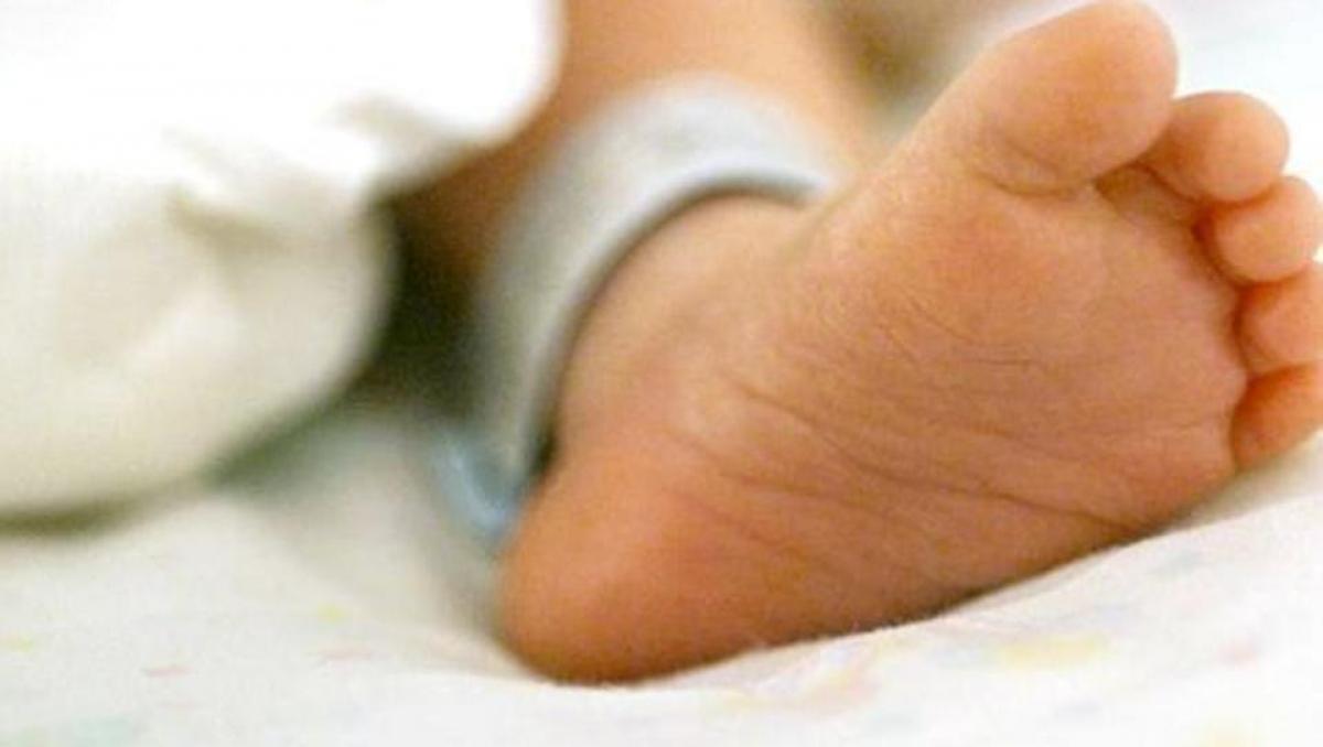 Baby born with four legs in Andhra Pradesh