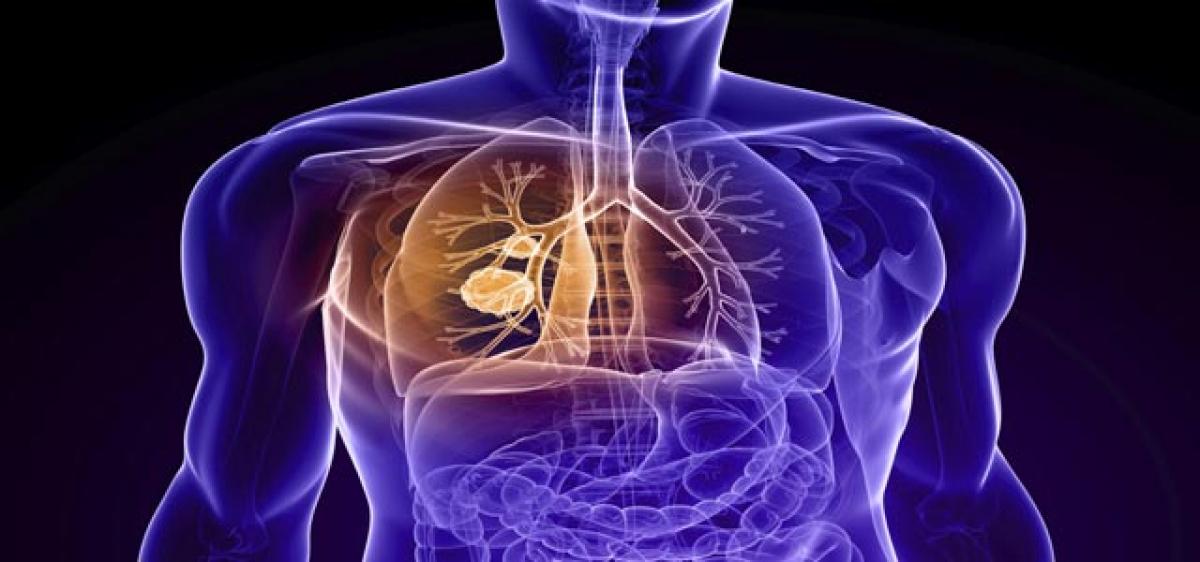 Long-term oxygen supplement has no impact on COPD patients