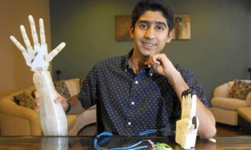 Indian boy in US develops inexpensive robotic arm for science project