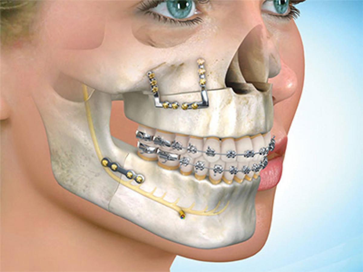 Inspiring maxillofacial surgeons