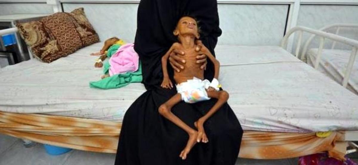 Wider Image: New famine fears loom in Yemen