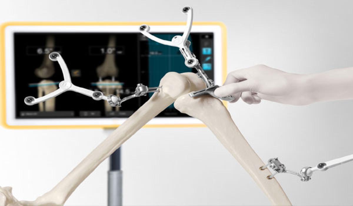 Navigation-3 system for joint replacement surgeries