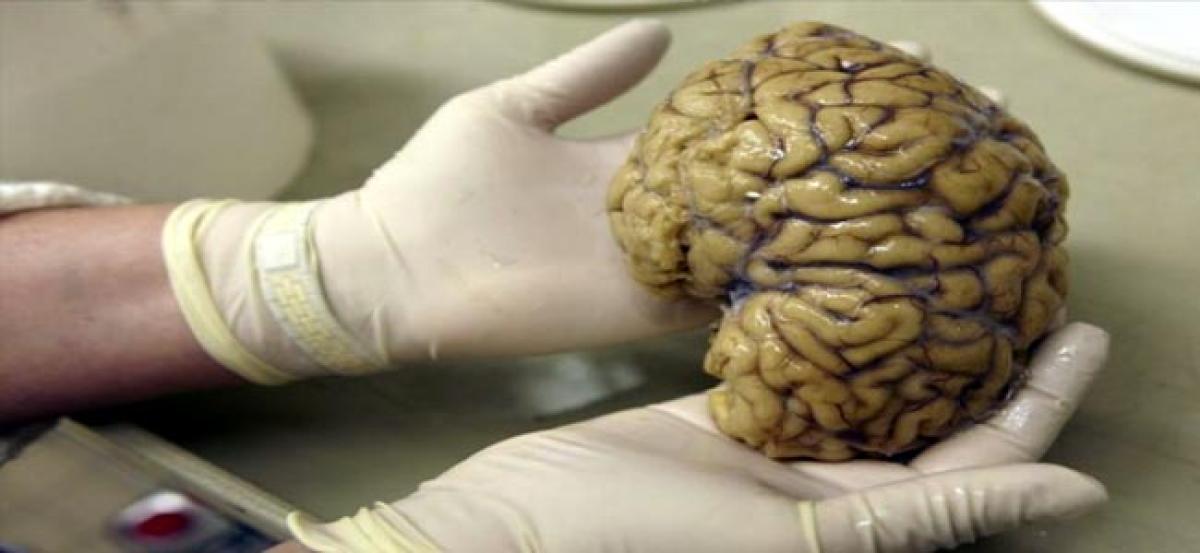 Tests may help spot brain damage after even mild concussions