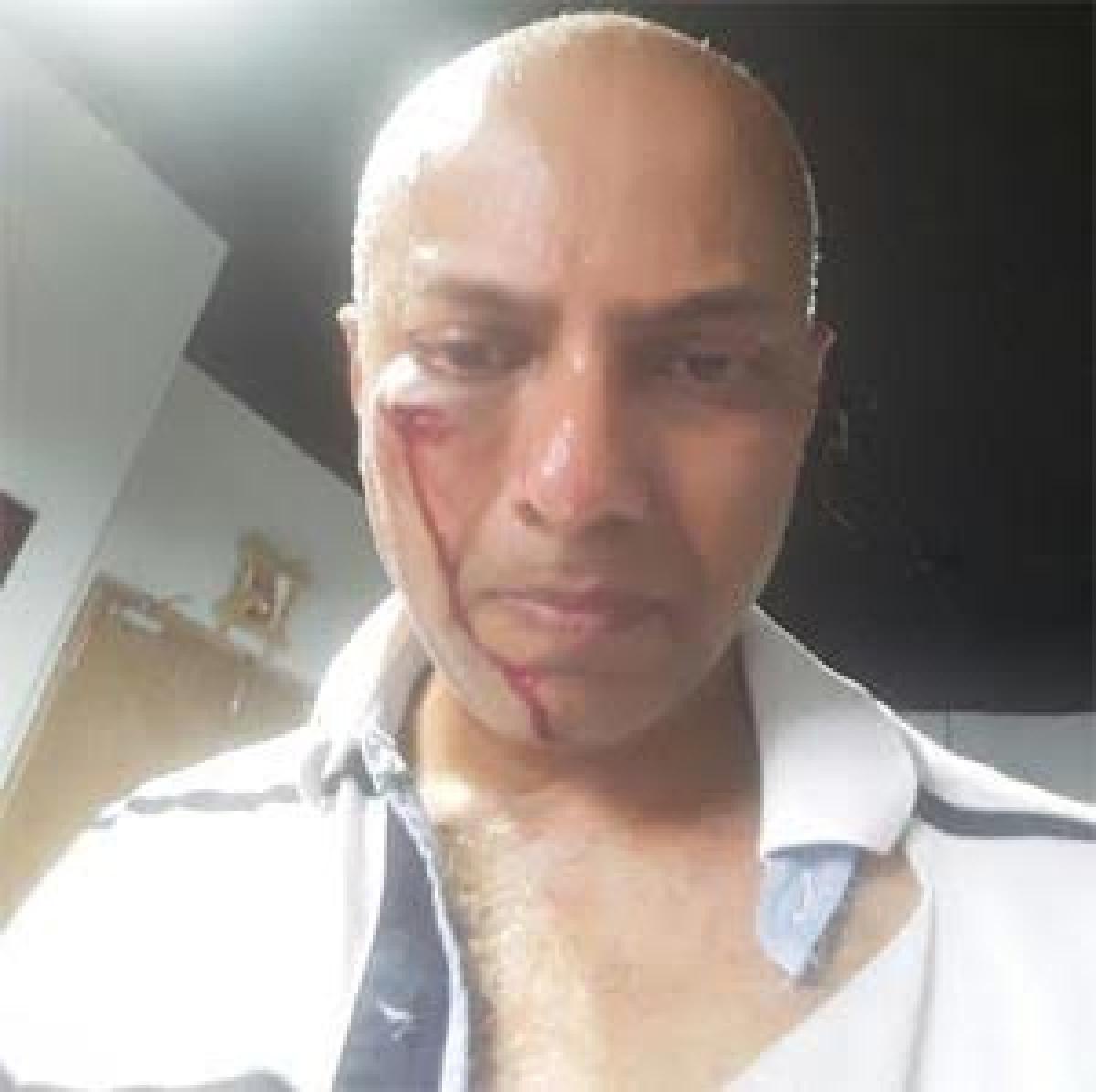 Tollywood music director attacked