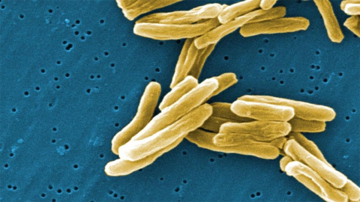 India must step up funding to control tuberculosis: WHO