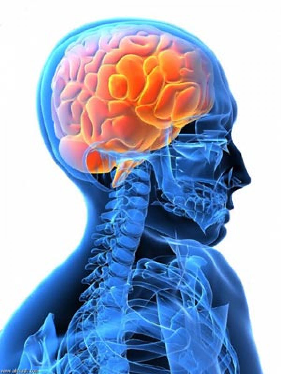 Genes linked to stroke risk identified