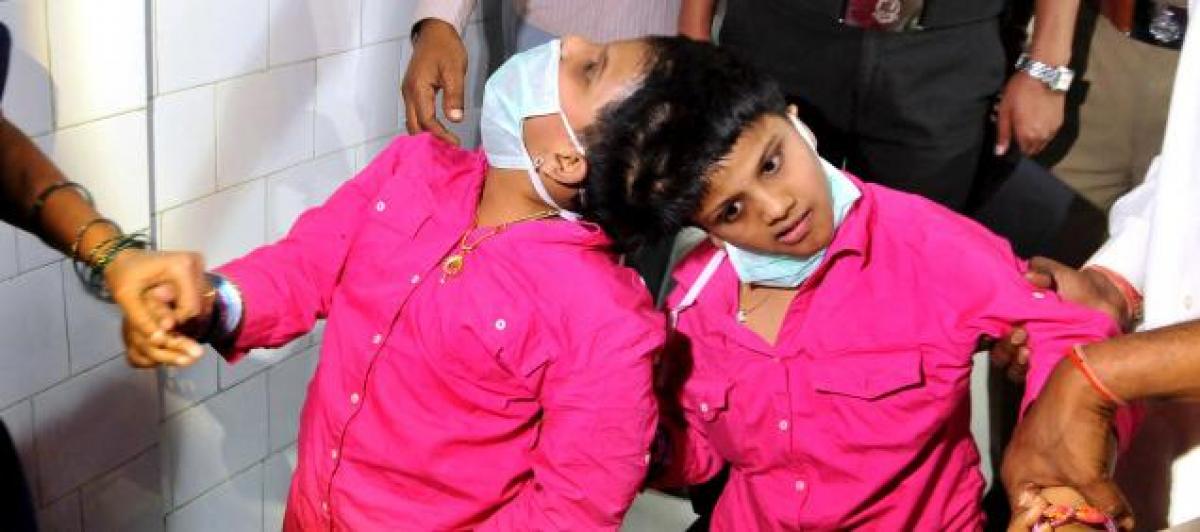 Siamese twins shifted from Hyderabad hospital to State Home