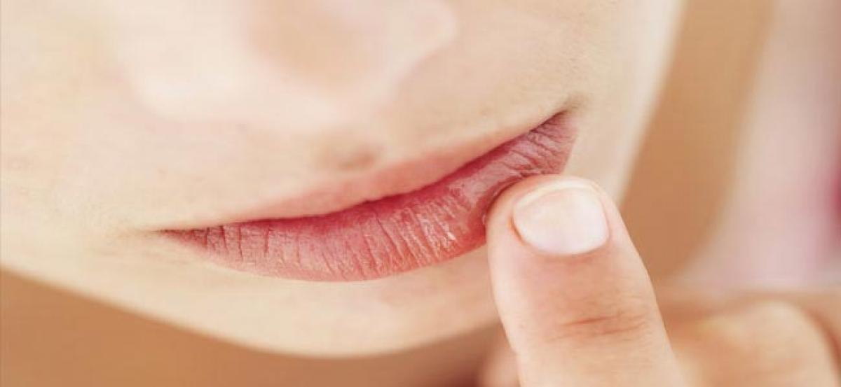 Say bye-bye to chapped lips in winter