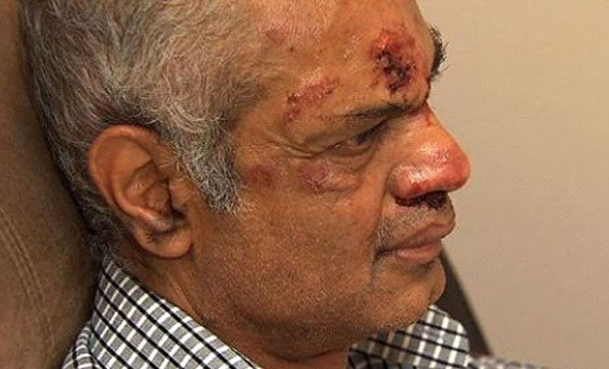 Indian man attacked in apparent hate crime in New Jersey