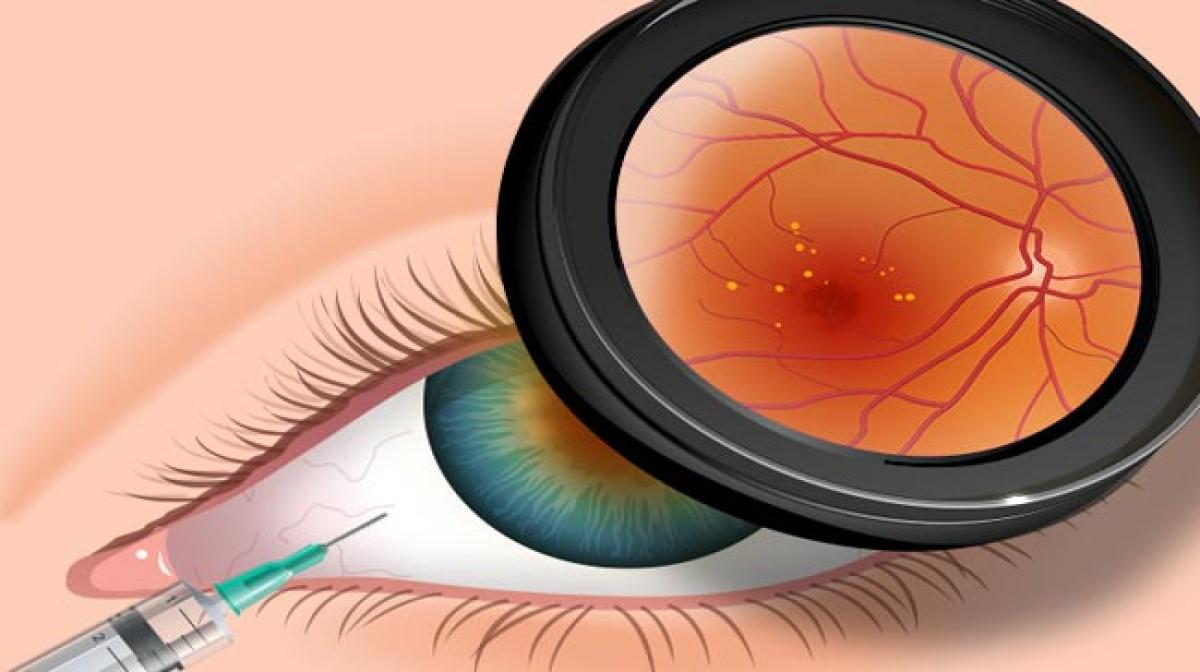 Global Ophthalmology Drugs Market to 2022 - Angiogenesis Modulators and Gene Therapies to Boost Overall Revenue within the Forecast Period : Ken Research