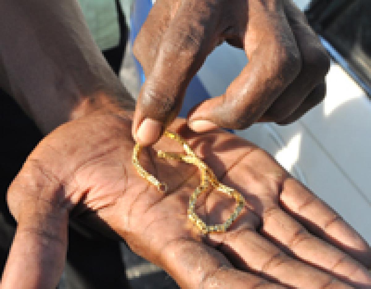 Doctors extract swallowed gold chain from thief