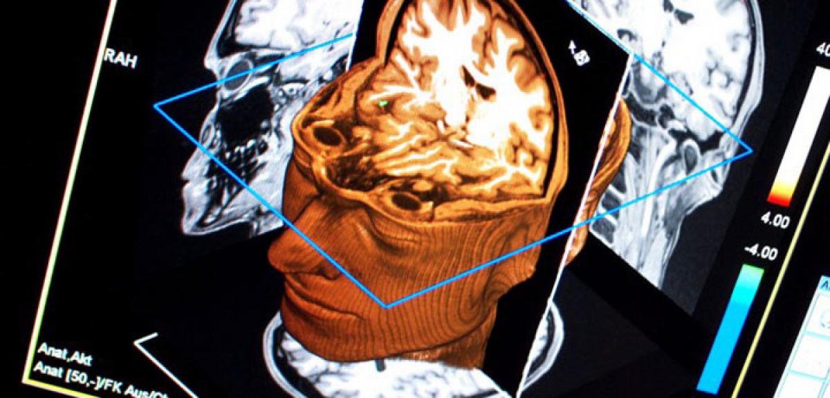 Key biological markers for psychotic disorders identified