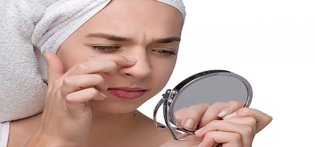 Natural ways to get rid of blackheads