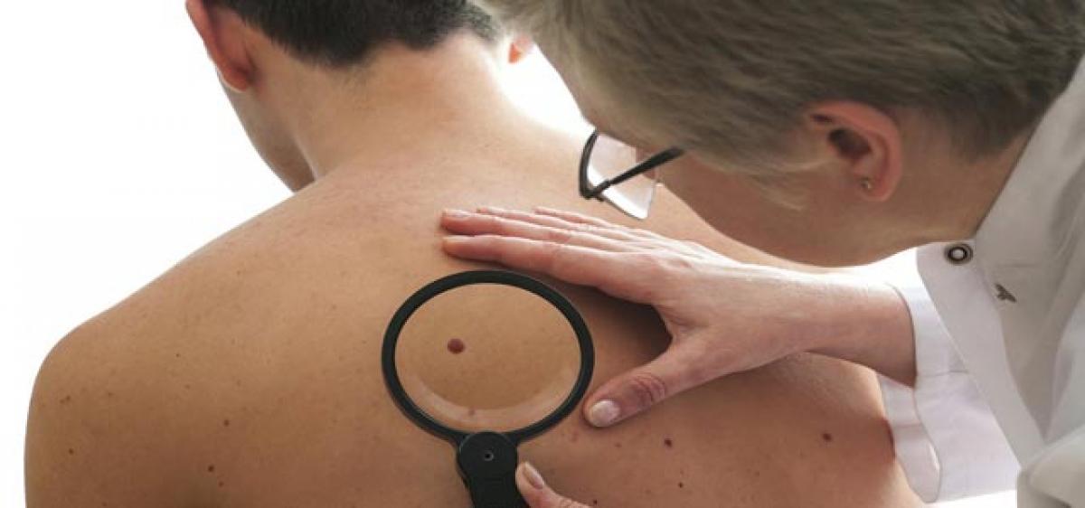 Novel drug may stop melanoma spread