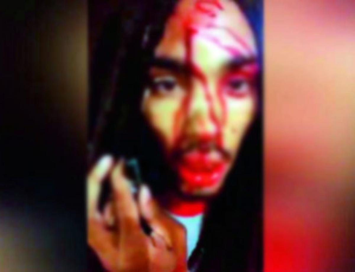 Rapper uploads gory image of bullet in his head on Facebook
