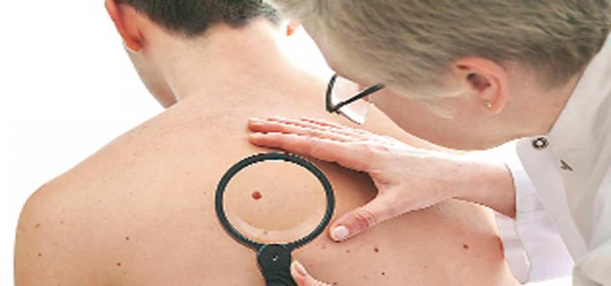 Novel drug may stop melanoma spread