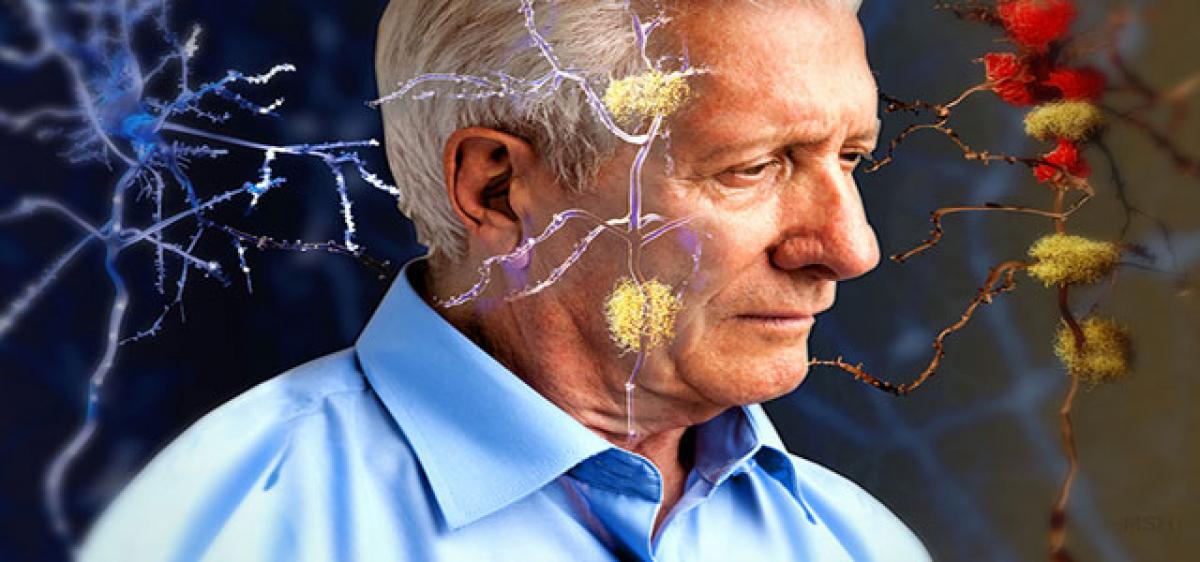 Saliva may disclose risk of Alzheimer’s disease