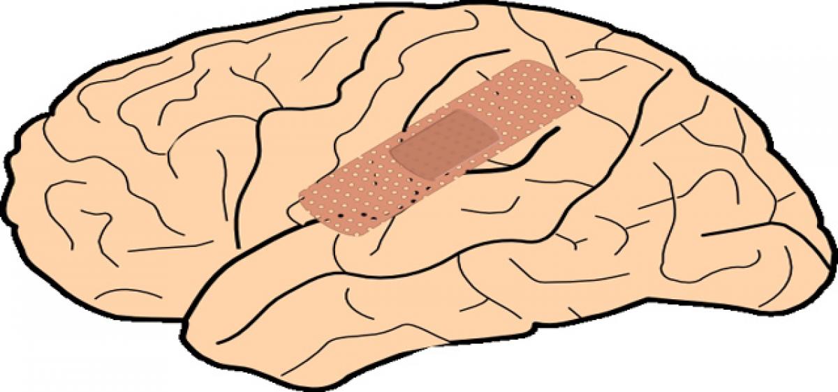 High BMI bad for your brain