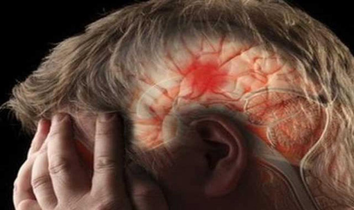 Brain Stroke: Symptoms and treatment