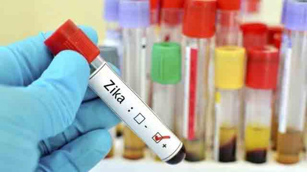 Spain records first case of sexually transmitted Zika virus