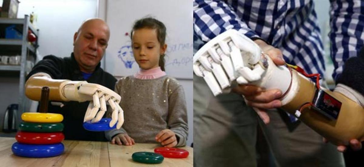 In his basement, son designs prosthetic arm for father in Belarus