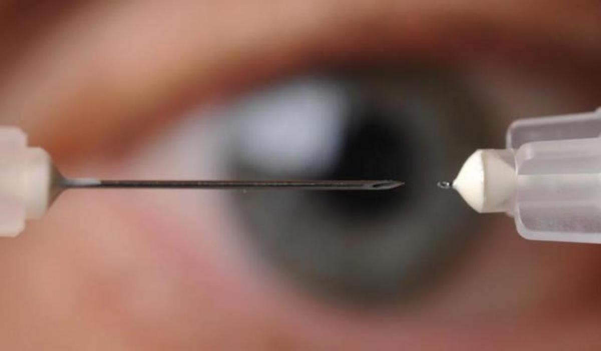 Stem cells injection could ward off glaucoma