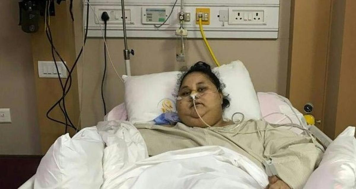 ‘World’s heaviest woman’ has surgery in India, loses 100 kgs